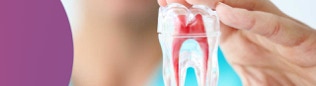 Root canal treatment