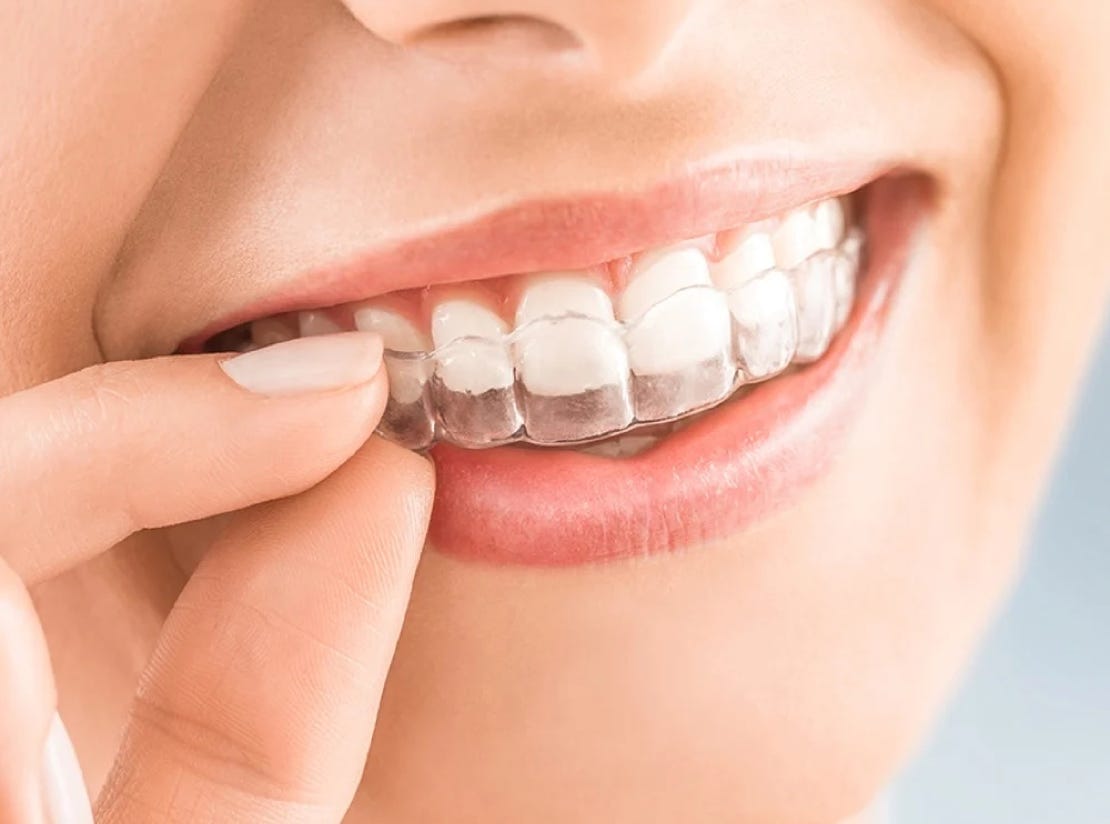 Invisalign clear aligners