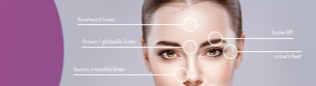 Botox treatment areas