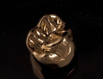 A Gold Crown
